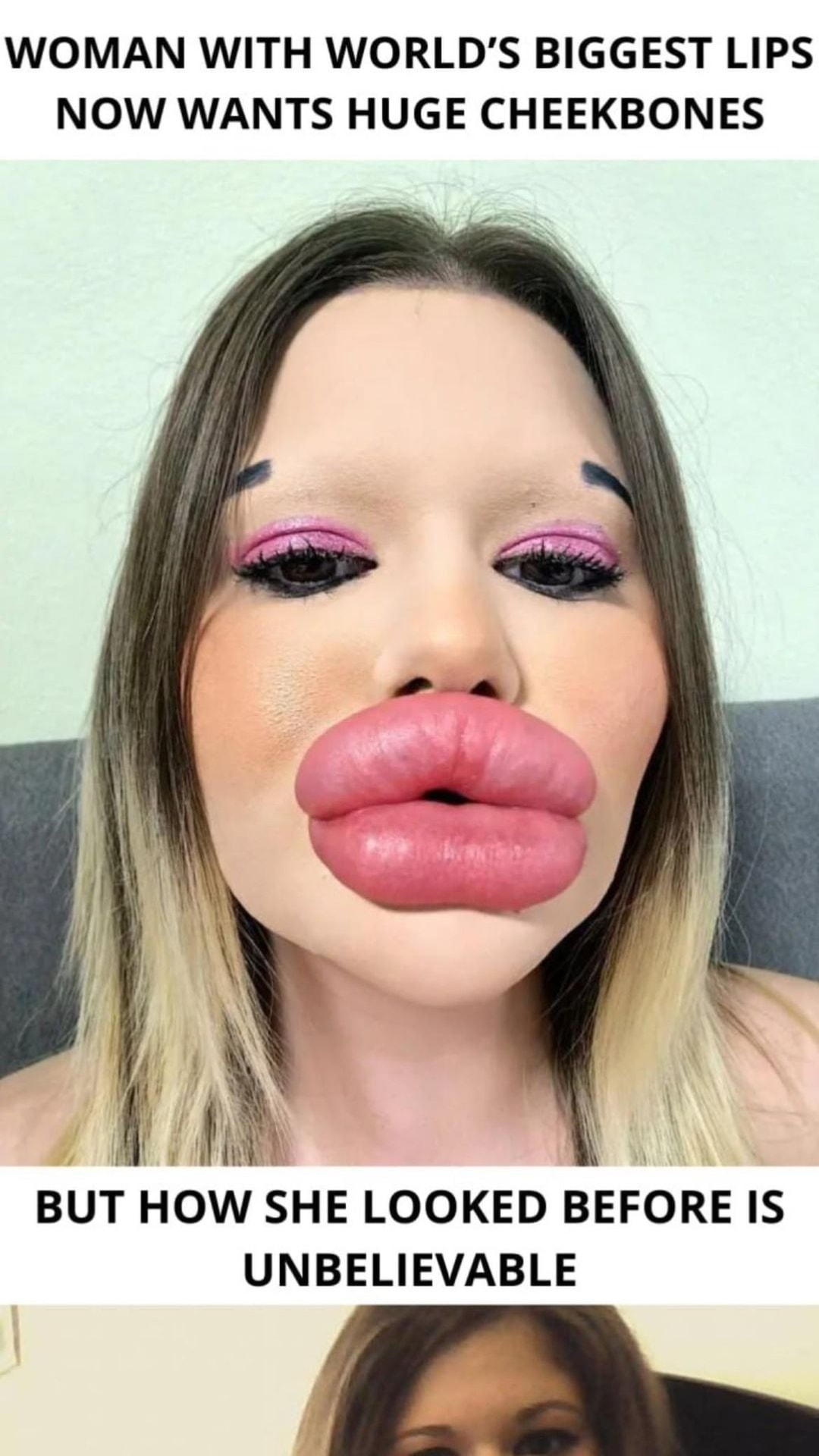 The individual boasting the largest lips on the planet!
