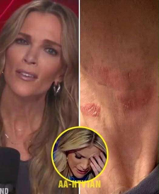 Megyn Kelly Hospitalized in Critical Condition… See more