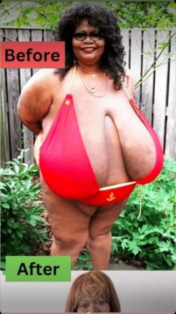 Obesity Is Becoming One of the Biggest Health Threats Worldwide